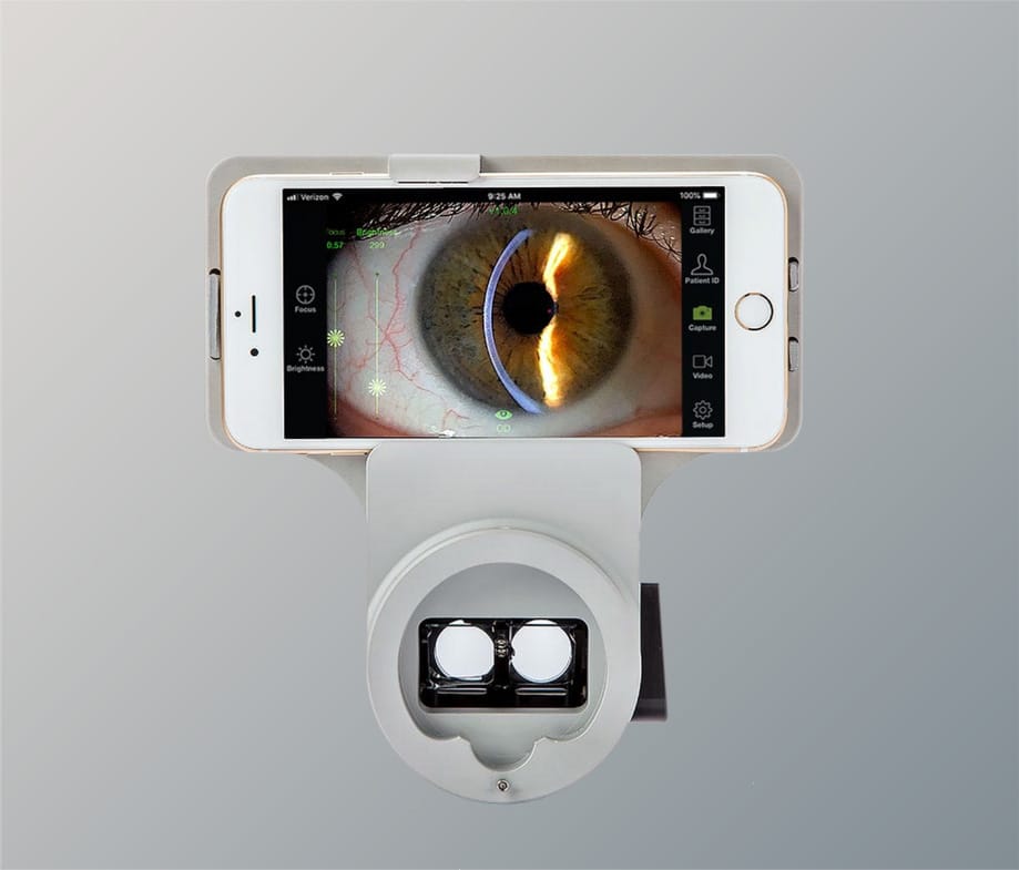 Slit lamp and Apple iPhone not included Slit lamp and Apple iPhone not included